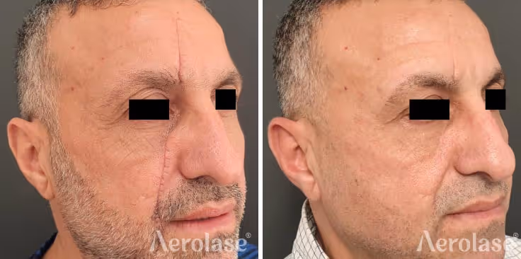 680aa00cbf38f3573f03f2dd_homepage-results-scar-watfa